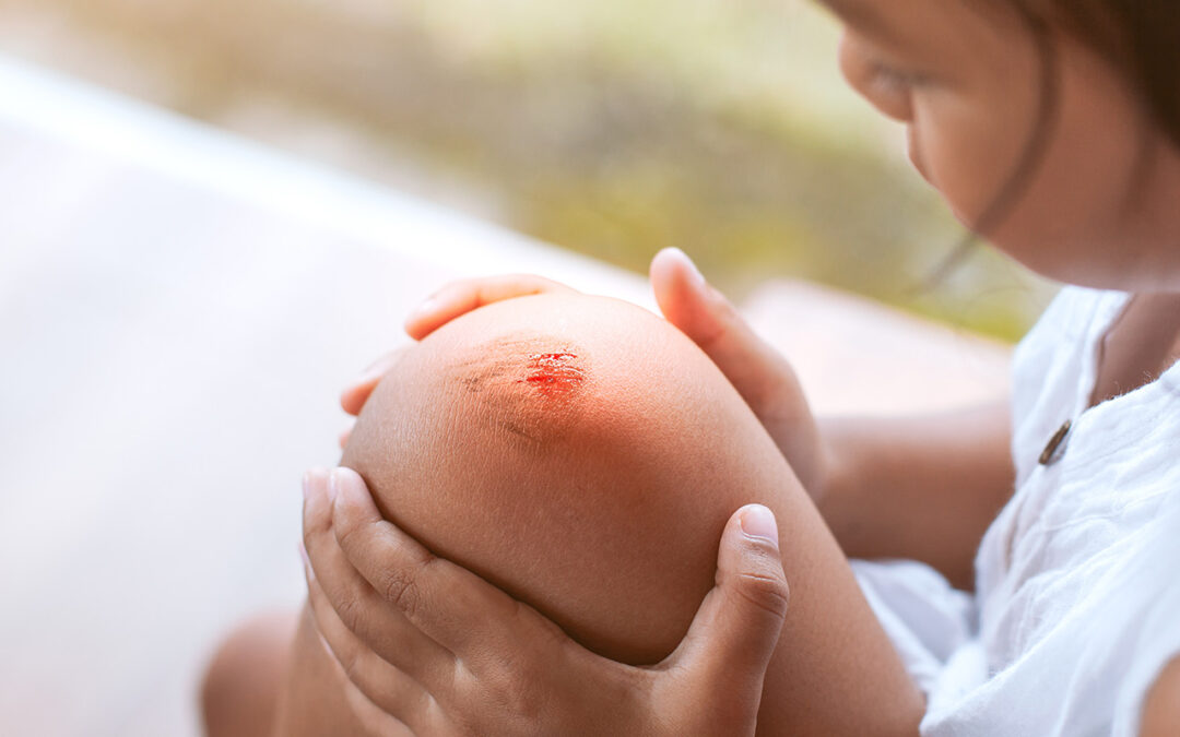 Verletzungen der Haut – optimale Wundversorgung und Abheilung